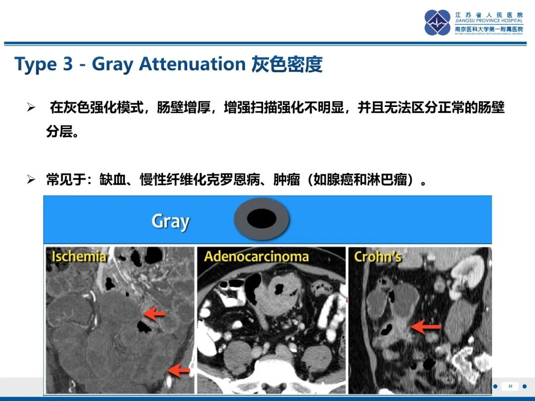 影像PPT - 【PPT】休克肠-22