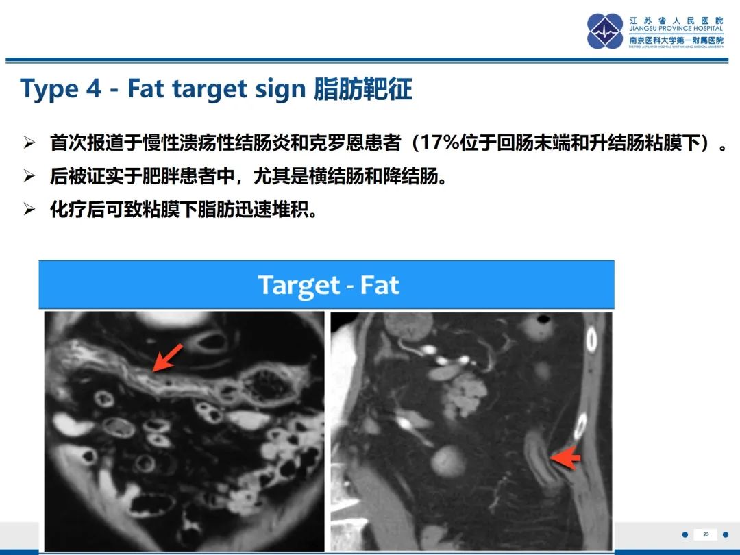影像PPT - 【PPT】休克肠-23