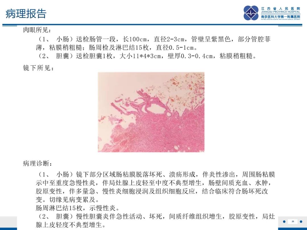 影像PPT - 【PPT】休克肠-28