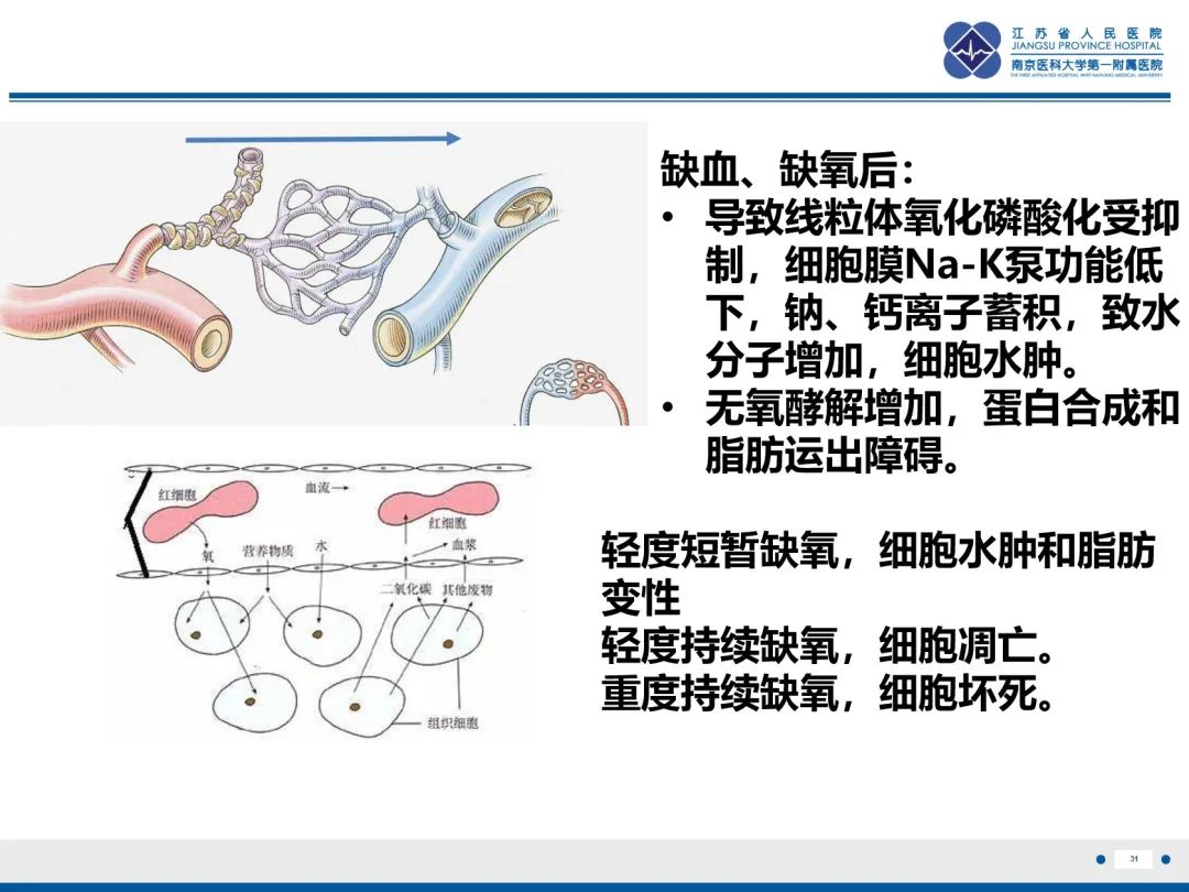 影像PPT - 【PPT】休克肠-31