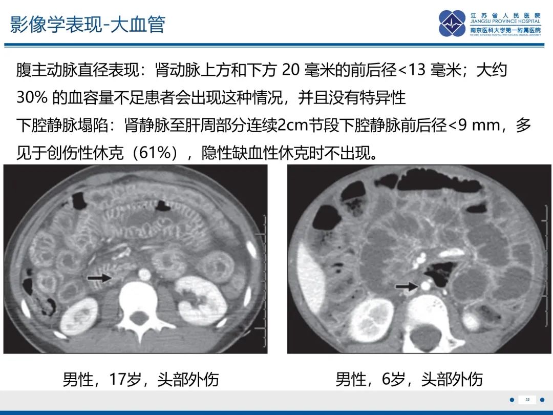 影像PPT - 【PPT】休克肠-32
