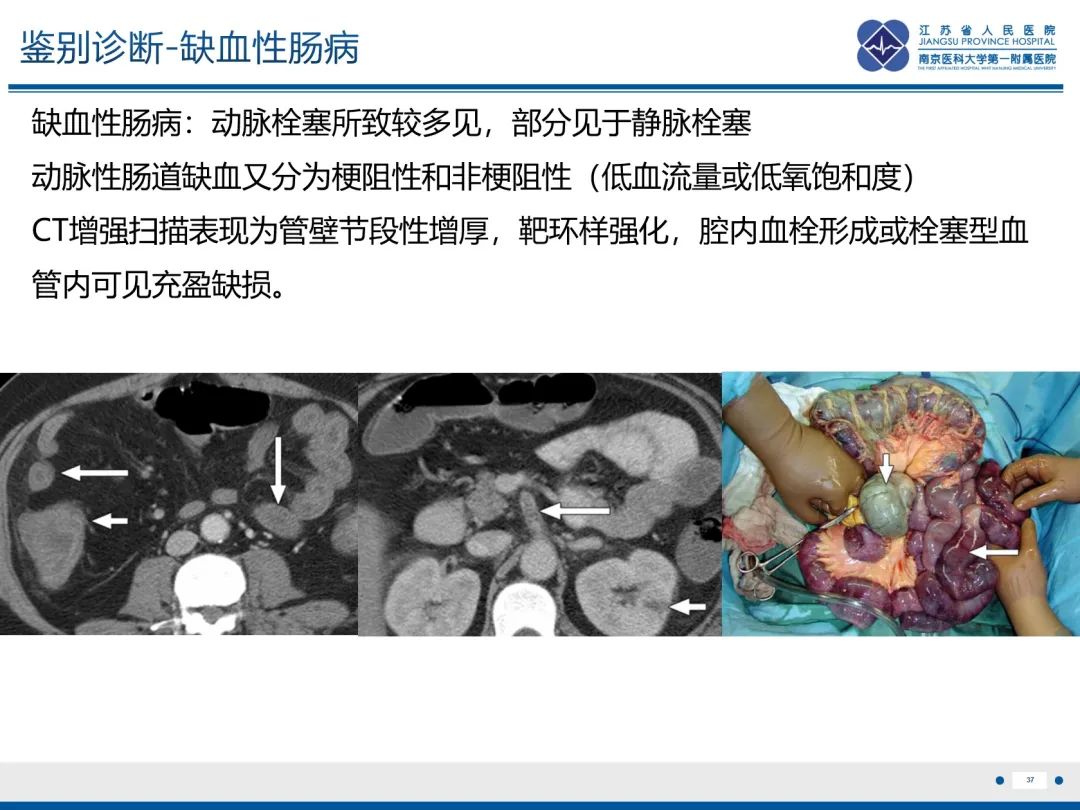 影像PPT - 【PPT】休克肠-37