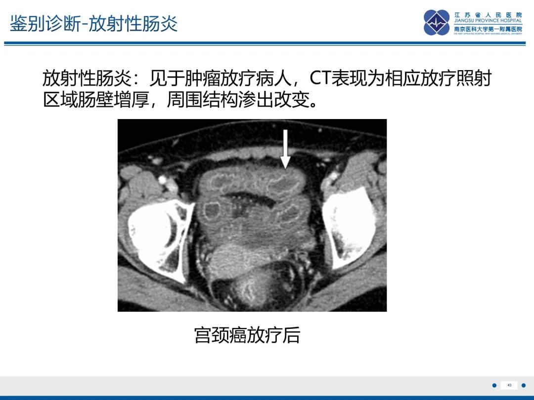 影像PPT - 【PPT】休克肠-43