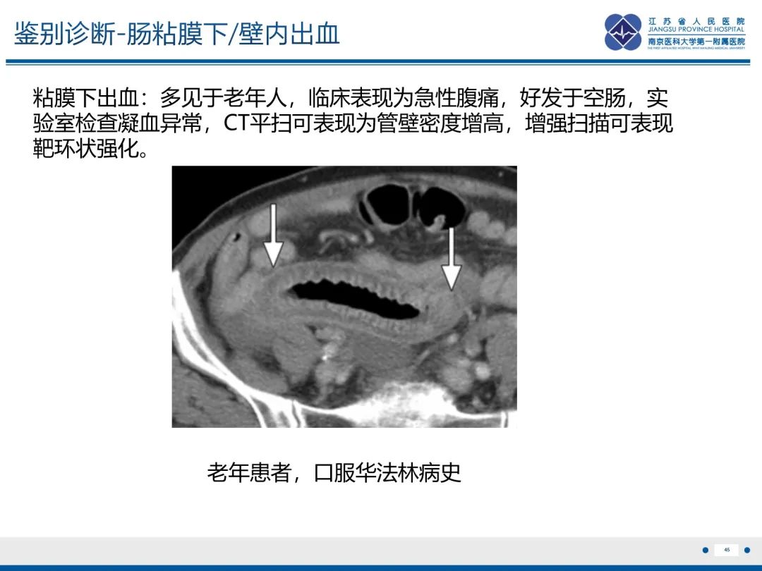影像PPT - 【PPT】休克肠-45