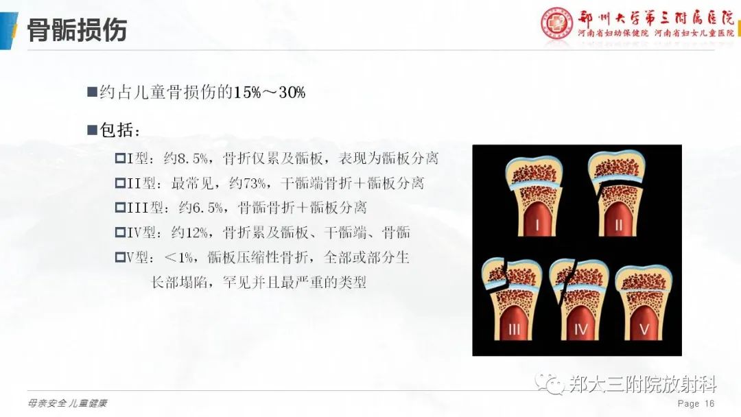 影像PPT - 【PPT】儿童骨折的影像诊断分析-16