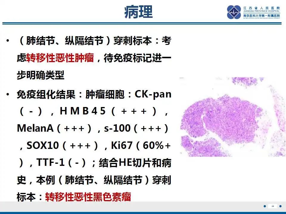 影像PPT - 【PPT】转移性黑色素瘤-27