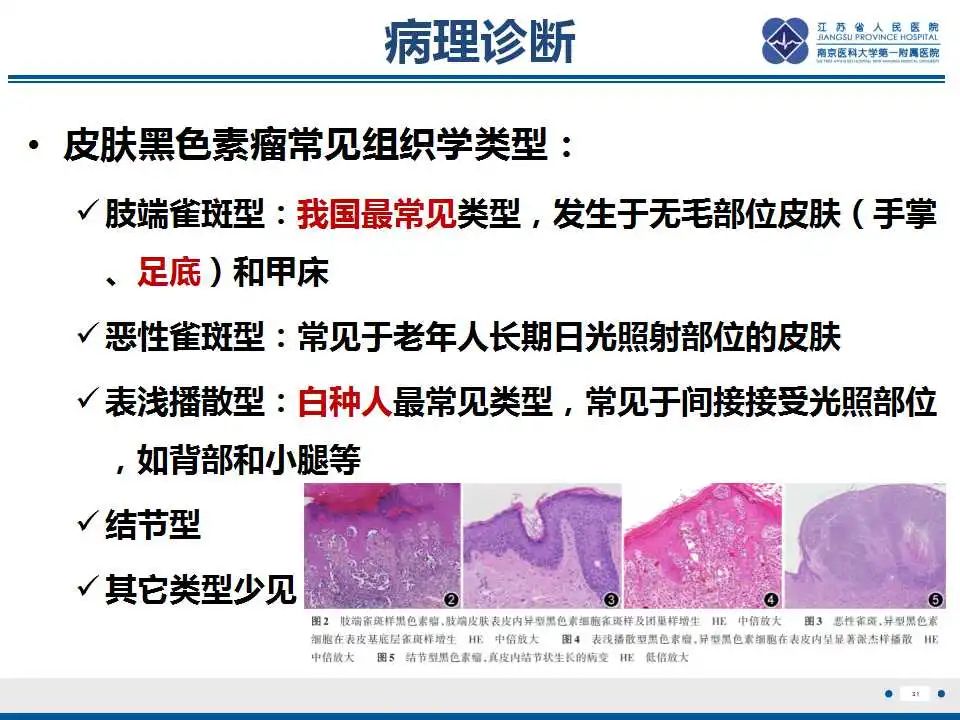 影像PPT - 【PPT】转移性黑色素瘤-32