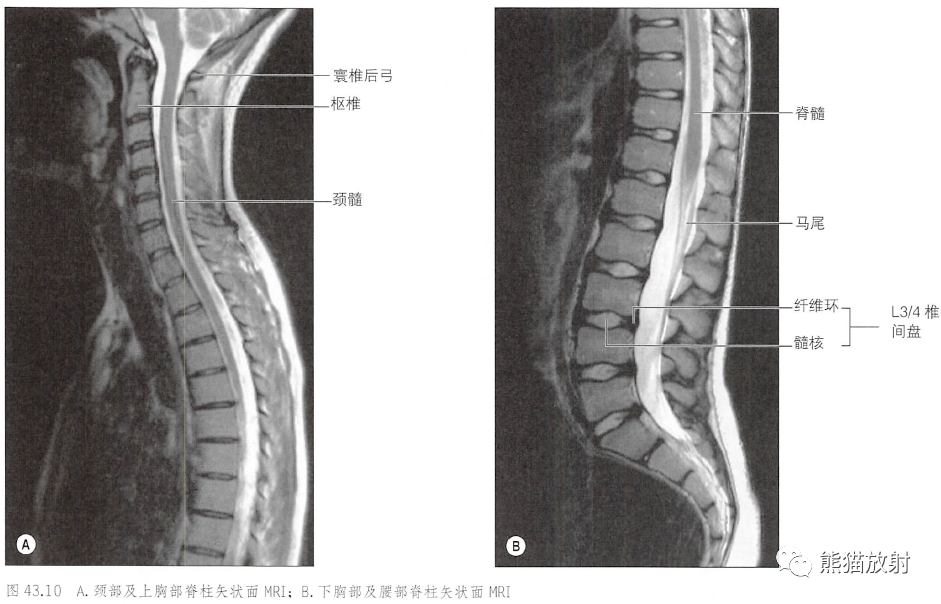 影像PPT - 脊柱(椎体、椎间盘、韧带)解剖-2 影像PPT - 脊柱(椎体、椎间盘、韧带)解剖-2