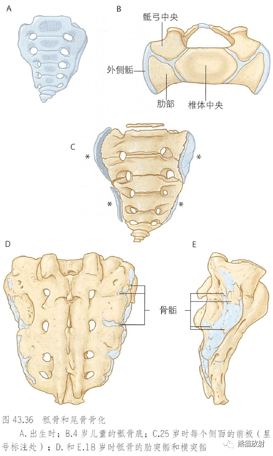 影像PPT - 脊柱(椎体、椎间盘、韧带)解剖-6 影像PPT - 脊柱(椎体、椎间盘、韧带)解剖-6