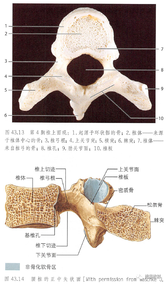 影像PPT - 脊柱(椎体、椎间盘、韧带)解剖-7 影像PPT - 脊柱(椎体、椎间盘、韧带)解剖-7