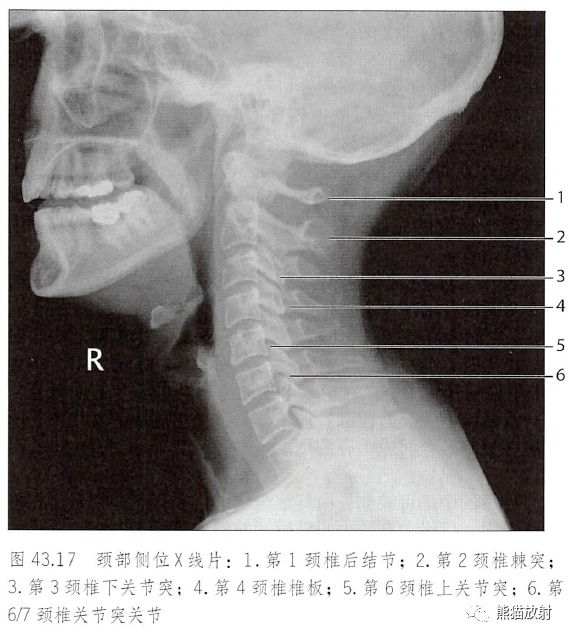 影像PPT - 脊柱(椎体、椎间盘、韧带)解剖-10 影像PPT - 脊柱(椎体、椎间盘、韧带)解剖-10