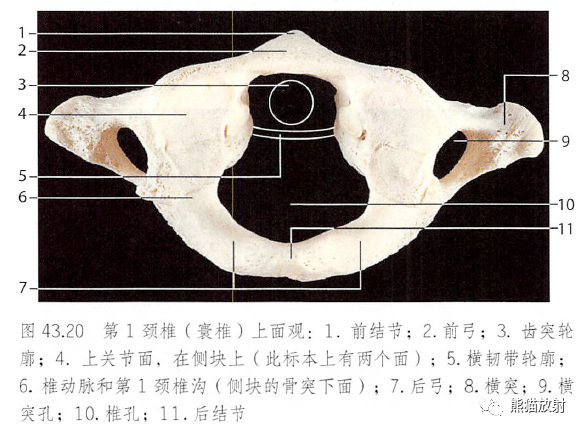 影像PPT - 脊柱(椎体、椎间盘、韧带)解剖-11 影像PPT - 脊柱(椎体、椎间盘、韧带)解剖-11