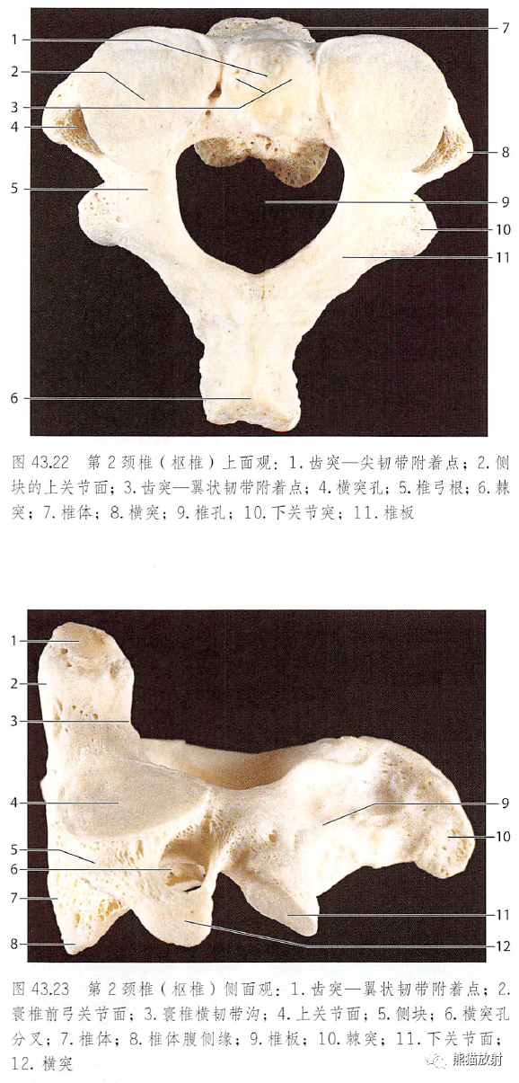 影像PPT - 脊柱(椎体、椎间盘、韧带)解剖-12 影像PPT - 脊柱(椎体、椎间盘、韧带)解剖-12