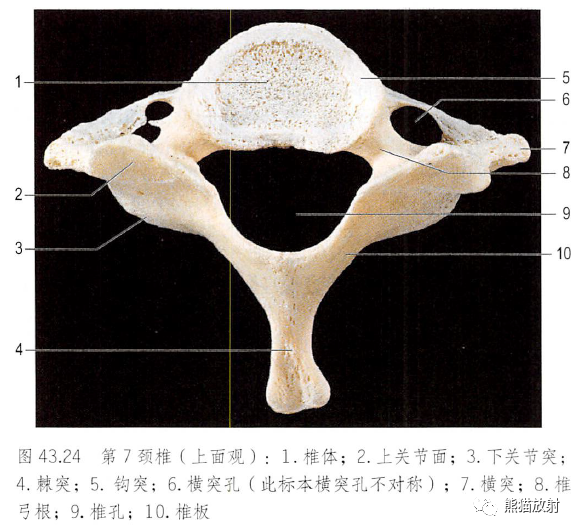 影像PPT - 脊柱(椎体、椎间盘、韧带)解剖-14 影像PPT - 脊柱(椎体、椎间盘、韧带)解剖-14