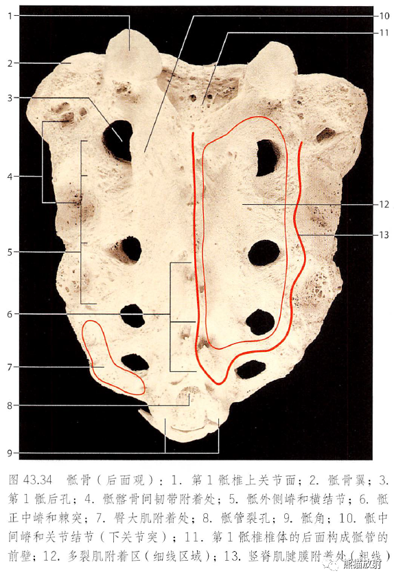 影像PPT - 脊柱(椎体、椎间盘、韧带)解剖-24 影像PPT - 脊柱(椎体、椎间盘、韧带)解剖-24