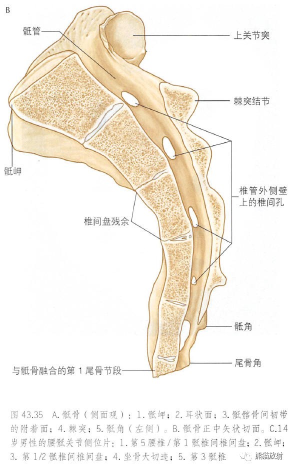 影像PPT - 脊柱(椎体、椎间盘、韧带)解剖-26 影像PPT - 脊柱(椎体、椎间盘、韧带)解剖-26