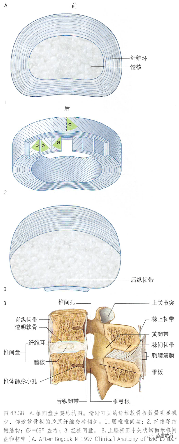 影像PPT - 脊柱(椎体、椎间盘、韧带)解剖-28 影像PPT - 脊柱(椎体、椎间盘、韧带)解剖-28