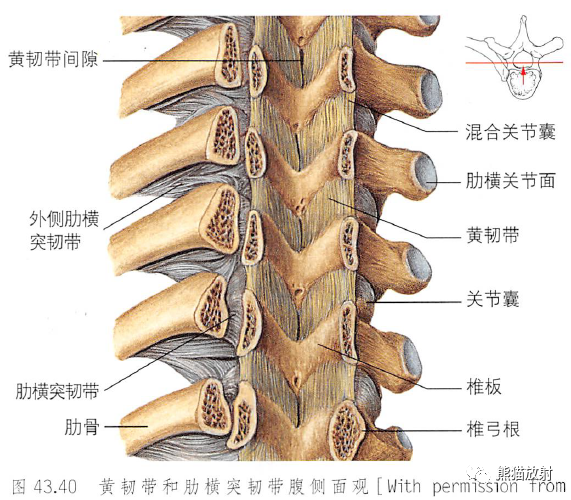 影像PPT - 脊柱(椎体、椎间盘、韧带)解剖-33 影像PPT - 脊柱(椎体、椎间盘、韧带)解剖-33