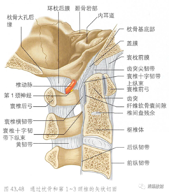 影像PPT - 脊柱(椎体、椎间盘、韧带)解剖-37 影像PPT - 脊柱(椎体、椎间盘、韧带)解剖-37