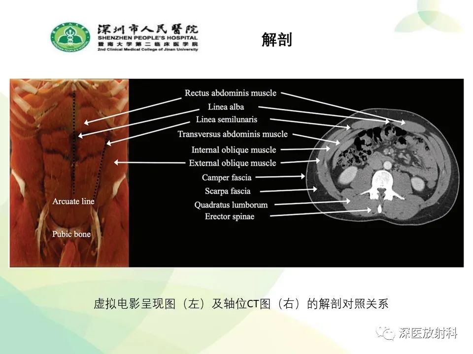 影像PPT - 【PPT】腹壁病变诊断思路-3