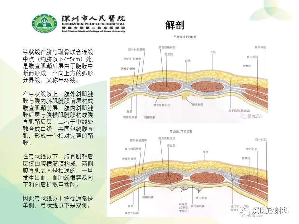 影像PPT - 【PPT】腹壁病变诊断思路-4