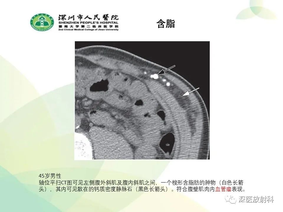 影像PPT - 【PPT】腹壁病变诊断思路-15