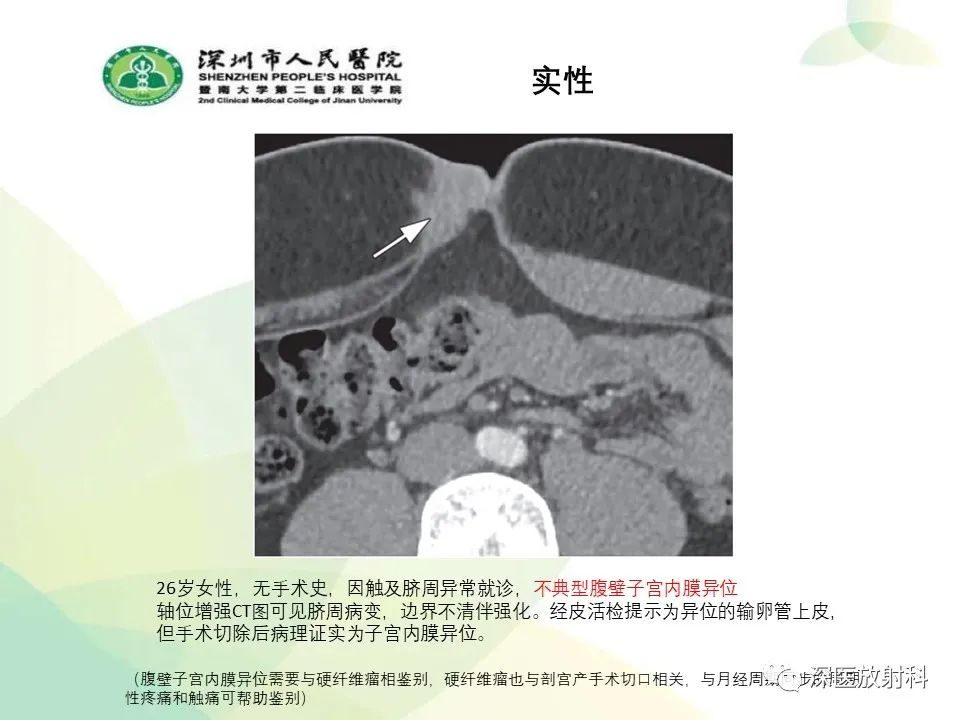 影像PPT - 【PPT】腹壁病变诊断思路-27