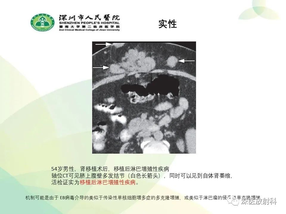 影像PPT - 【PPT】腹壁病变诊断思路-38