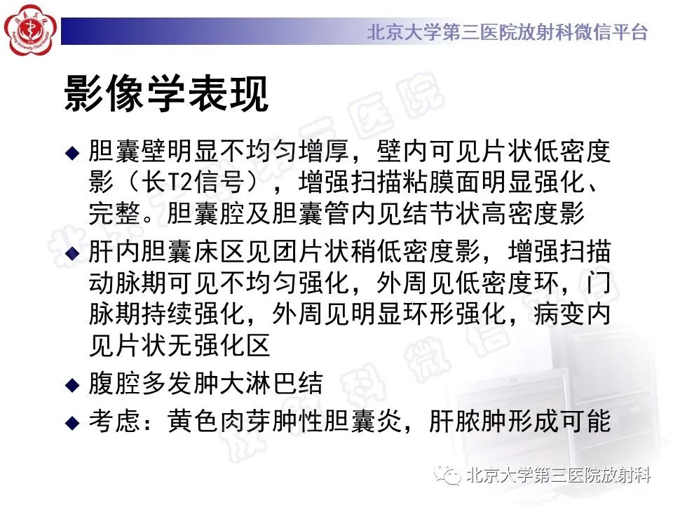 影像PPT - 【PPT】黄色肉芽肿性胆囊炎-9