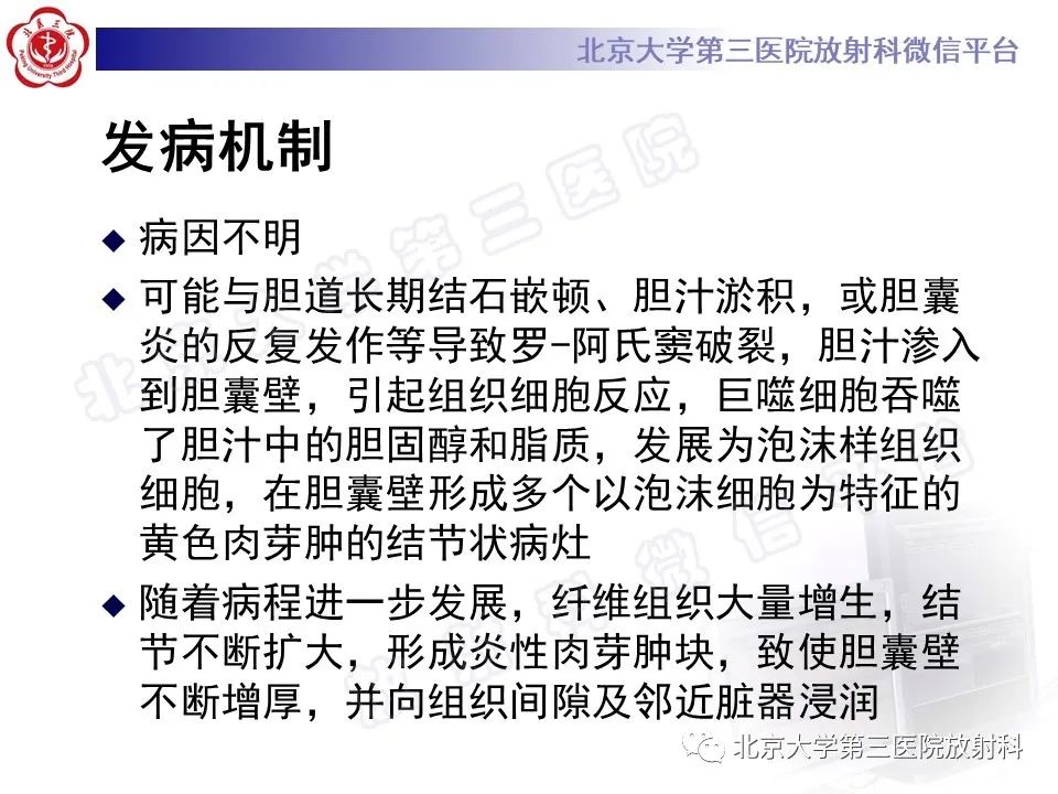 影像PPT - 【PPT】黄色肉芽肿性胆囊炎-15
