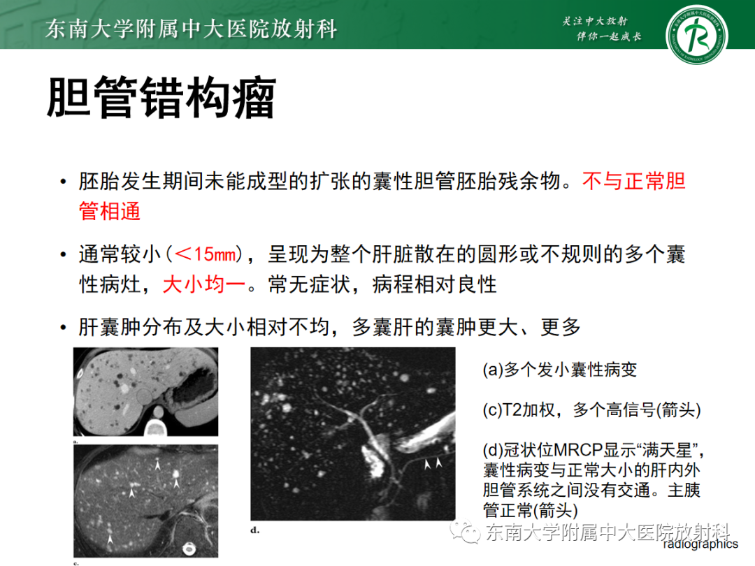 影像PPT - 【PPT】常见肝脏囊性病变的影像表现-9