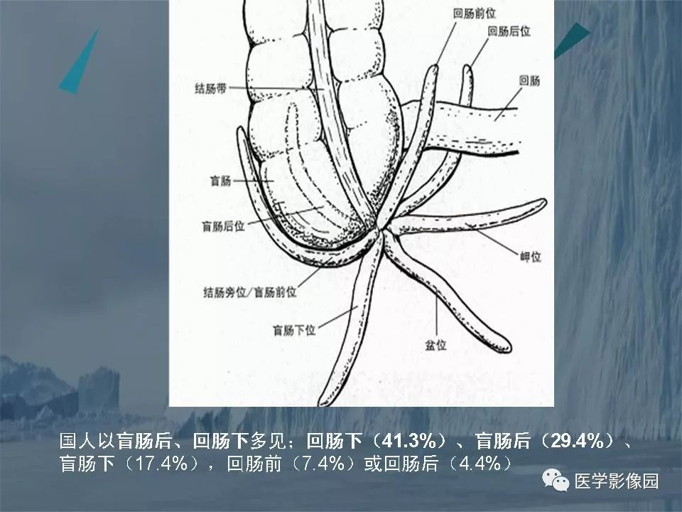 影像PPT - 【PPT】阑尾炎的CT诊断-9