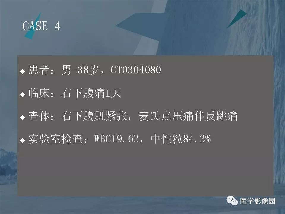 影像PPT - 【PPT】阑尾炎的CT诊断-29