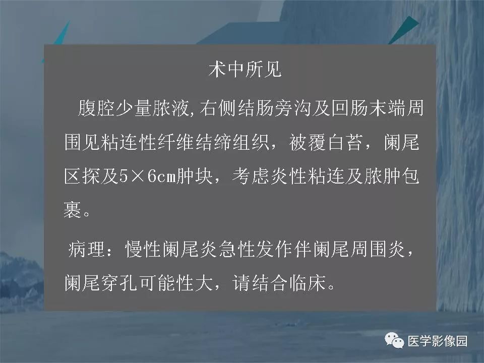 影像PPT - 【PPT】阑尾炎的CT诊断-35