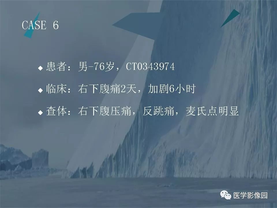 影像PPT - 【PPT】阑尾炎的CT诊断-36