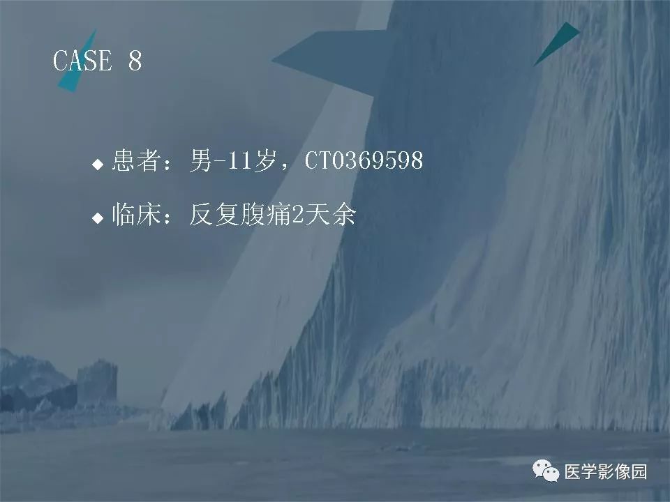 影像PPT - 【PPT】阑尾炎的CT诊断-43