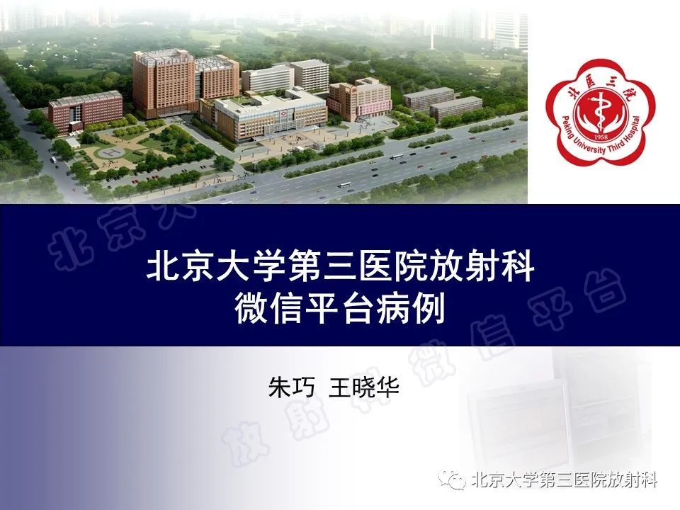 影像PPT - 【PPT】原发性肺淋巴上皮瘤样癌-1