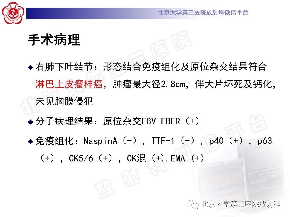 影像PPT - 【PPT】原发性肺淋巴上皮瘤样癌-11