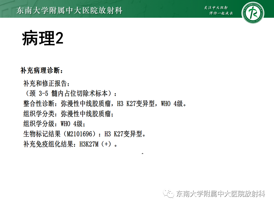 影像PPT - 【PPT】弥漫性中线胶质瘤-6 影像PPT - 【PPT】弥漫性中线胶质瘤-6
