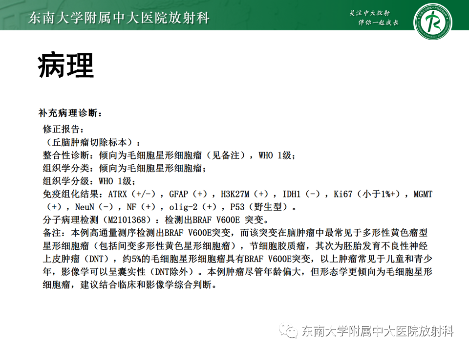影像PPT - 【PPT】弥漫性中线胶质瘤-35 影像PPT - 【PPT】弥漫性中线胶质瘤-35