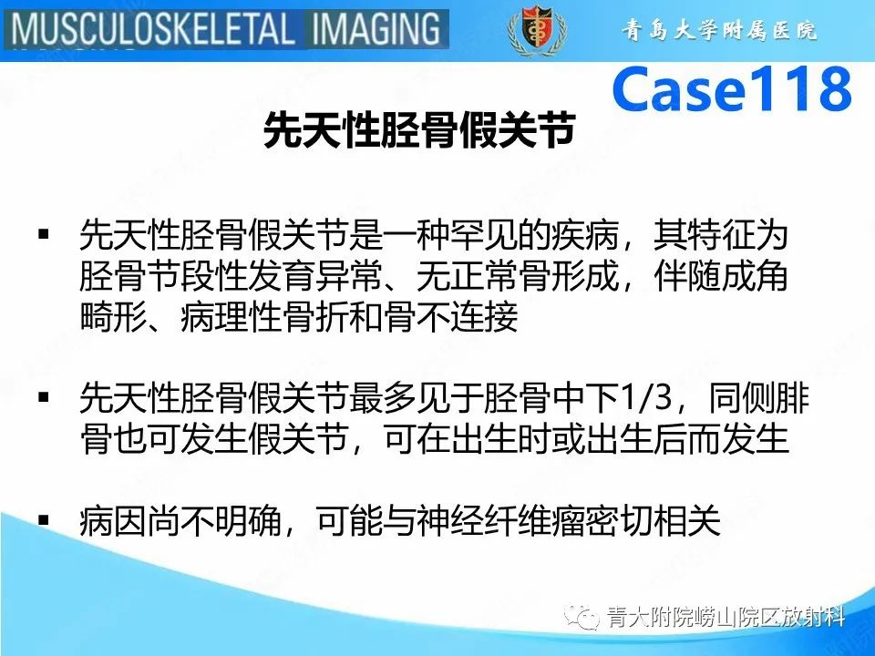 影像PPT - 【PPT】胫骨假关节：神经纤维瘤病 Ⅰ型-12