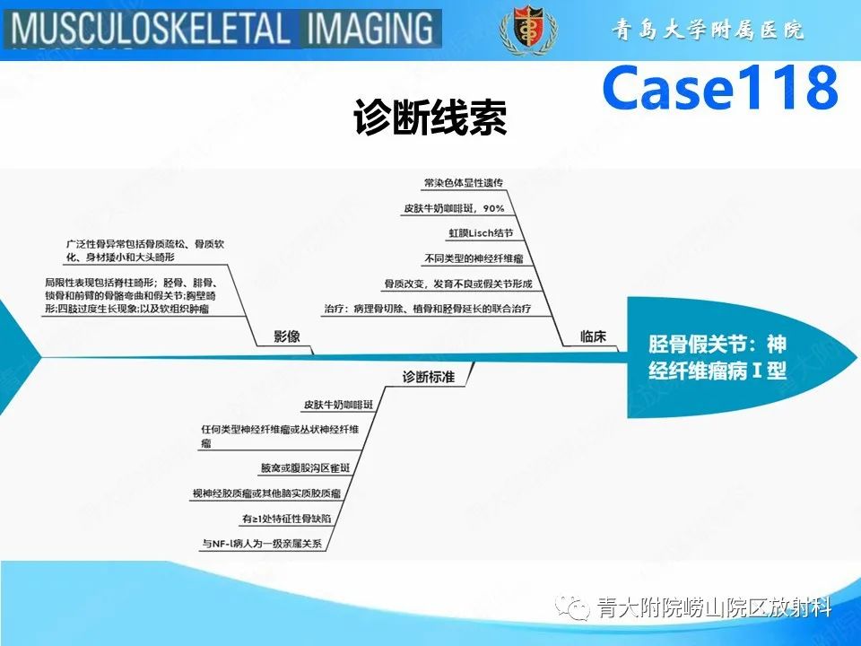 影像PPT - 【PPT】胫骨假关节：神经纤维瘤病 Ⅰ型-26