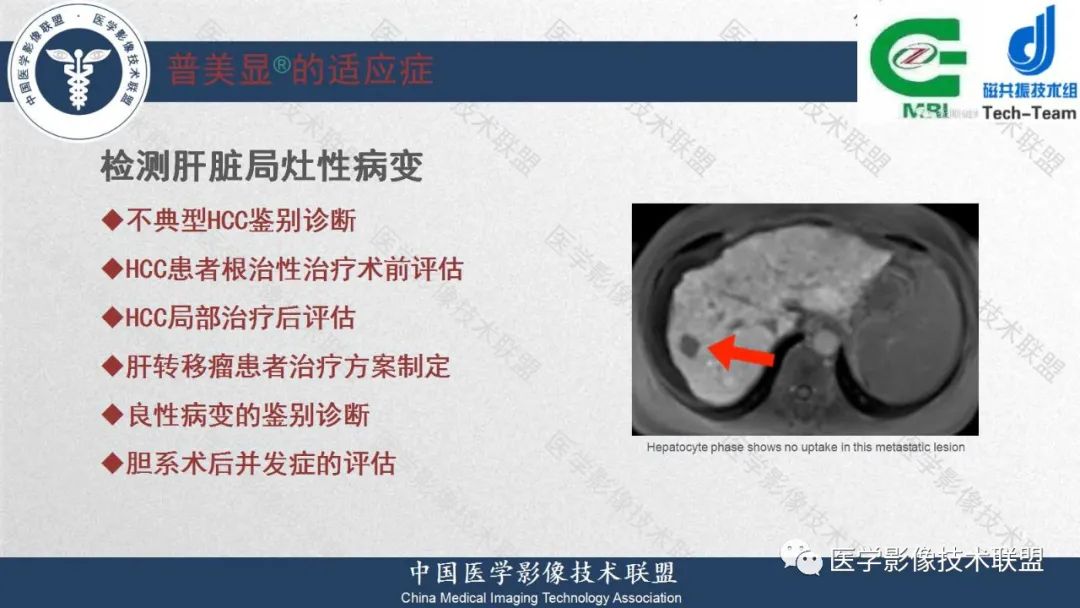 影像PPT - 【PPT】肝脏磁共振规范化扫描特异性对比剂增强MR—扫描方案与经验分享-6