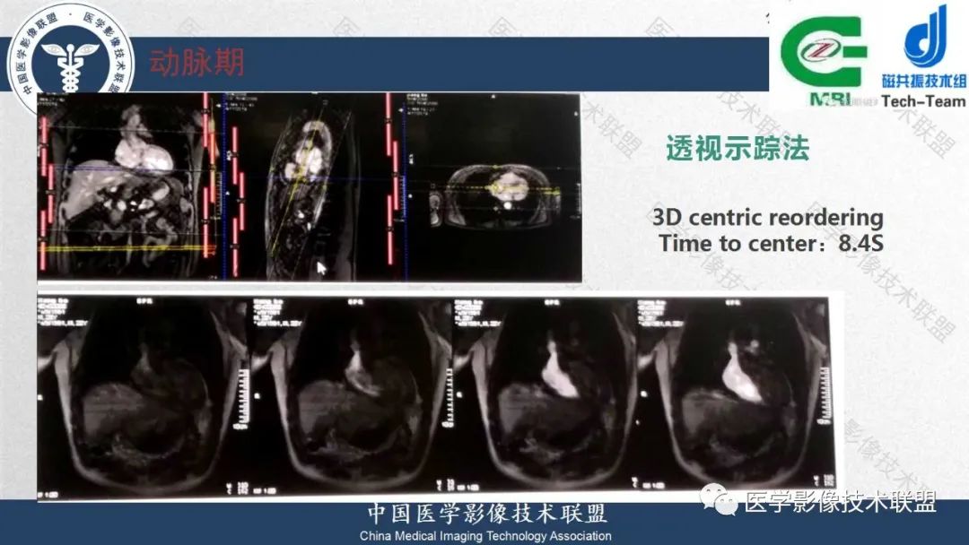 影像PPT - 【PPT】肝脏磁共振规范化扫描特异性对比剂增强MR—扫描方案与经验分享-17