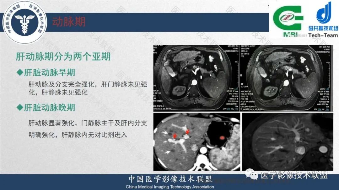 影像PPT - 【PPT】肝脏磁共振规范化扫描特异性对比剂增强MR—扫描方案与经验分享-14