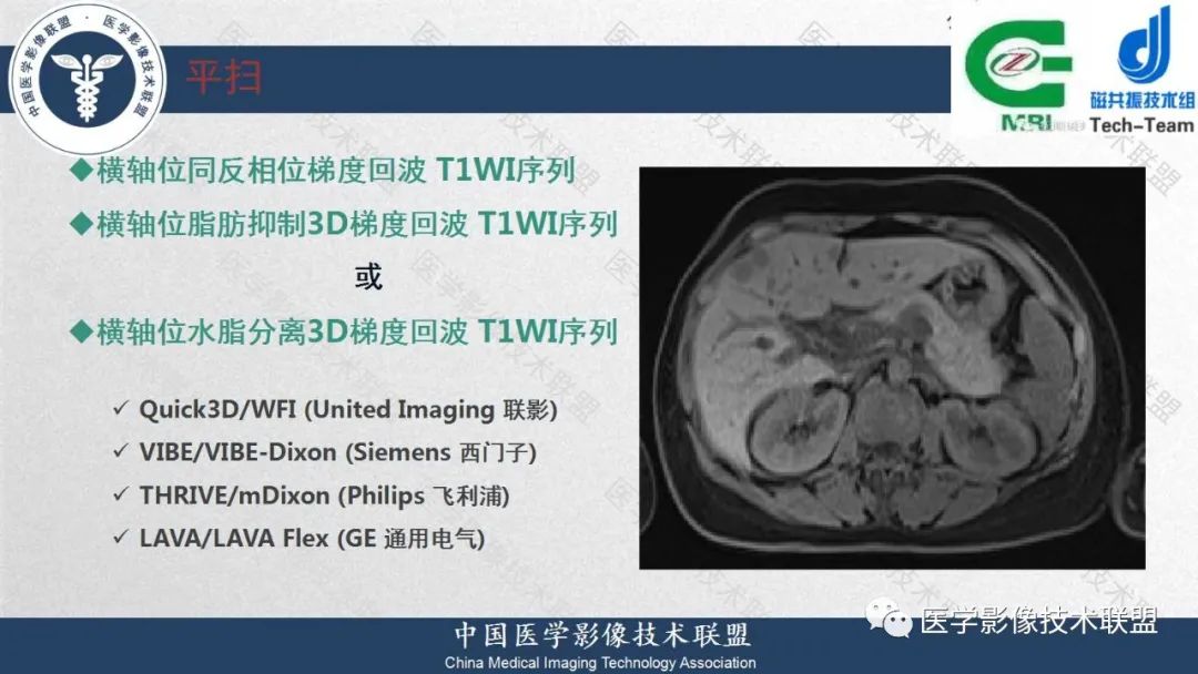影像PPT - 【PPT】肝脏磁共振规范化扫描特异性对比剂增强MR—扫描方案与经验分享-13