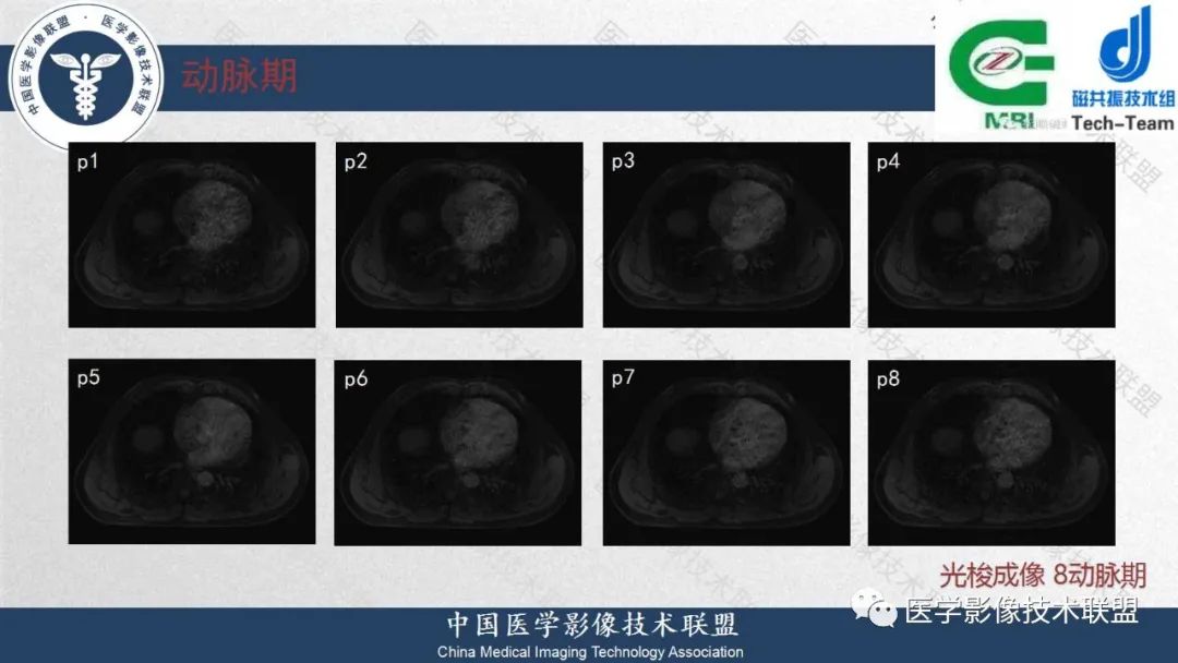 影像PPT - 【PPT】肝脏磁共振规范化扫描特异性对比剂增强MR—扫描方案与经验分享-18