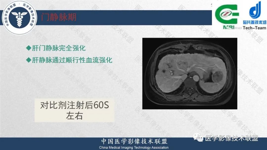 影像PPT - 【PPT】肝脏磁共振规范化扫描特异性对比剂增强MR—扫描方案与经验分享-19