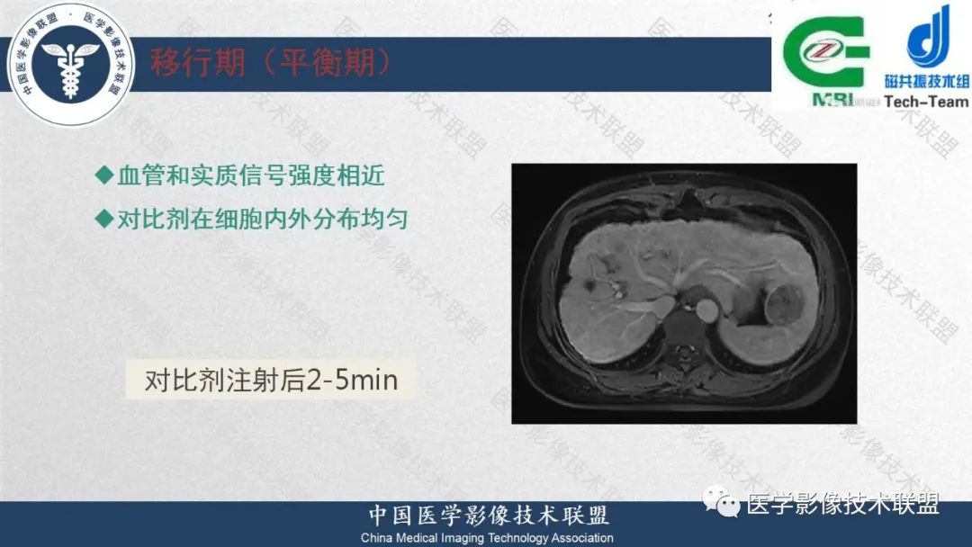 影像PPT - 【PPT】肝脏磁共振规范化扫描特异性对比剂增强MR—扫描方案与经验分享-20