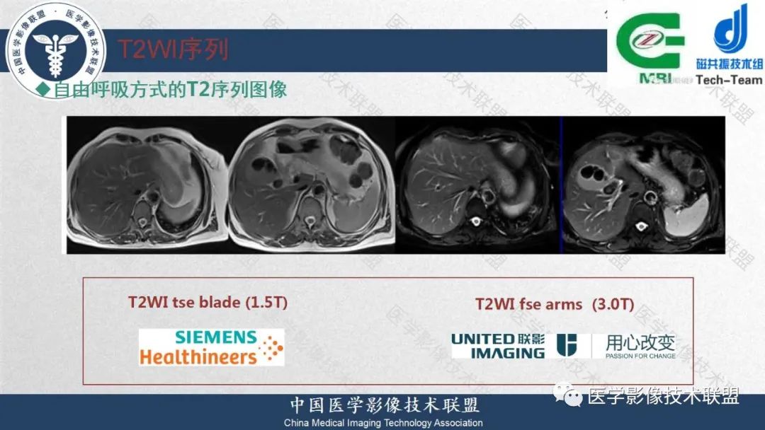 影像PPT - 【PPT】肝脏磁共振规范化扫描特异性对比剂增强MR—扫描方案与经验分享-21